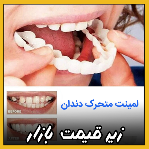 لمینت متحرک دندان / پروتز / ایمپلنت