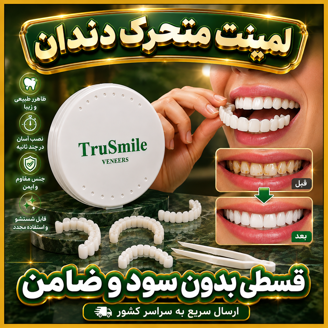 لمینت متحرک دندان ایمپلنت جادویی پروتز فوری ارسال فوری از مشهد اهواز شیراز کرمان تبریز قم کرج تهران