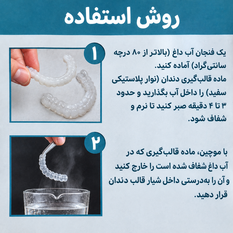 لمینت متحرک دندان دو فک ( قسطی بدون کارمزد ) (راهنمای استفاده در توضیحات را بخوانید)